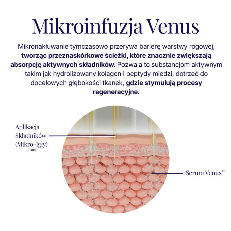 System Mikro-Infuzji