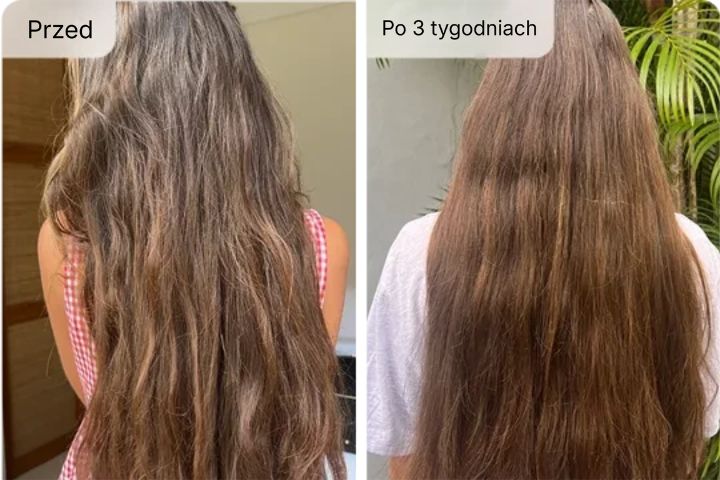 Filtr Prysznicowy