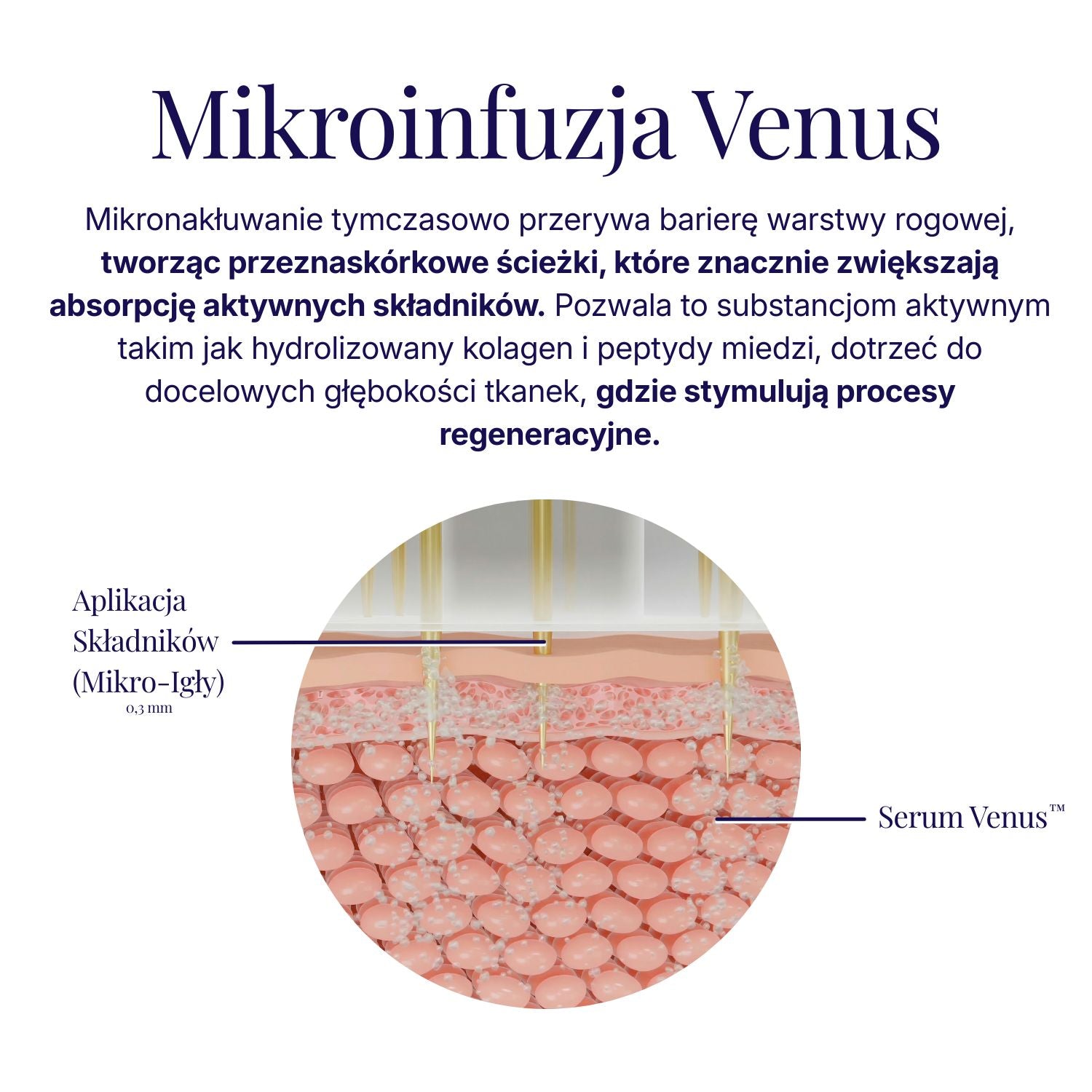 System Mikro-Infuzji